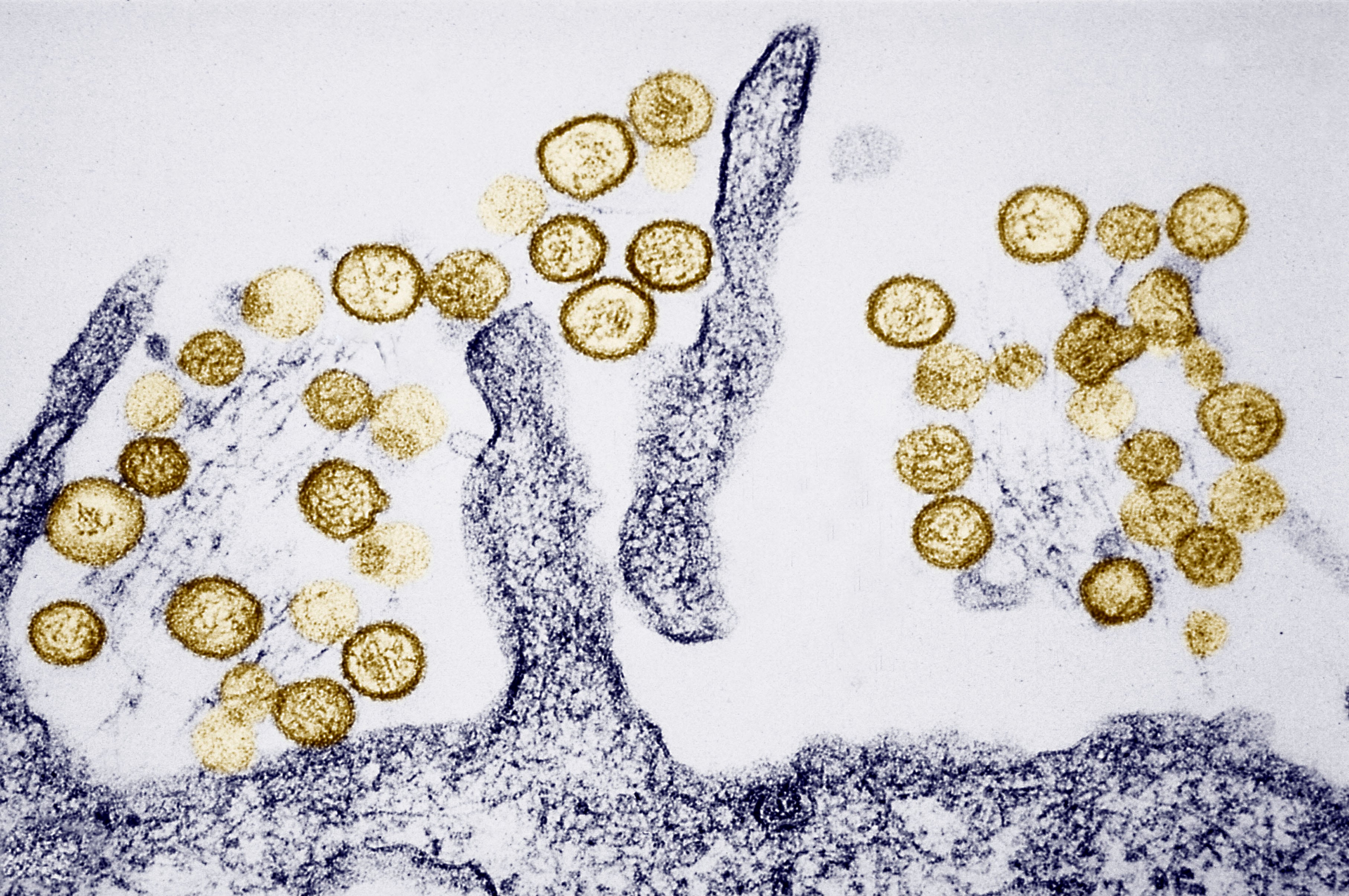 ¿Qué sabemos sobre el brote de hantavirus? Riesgos y certezas de una enfermedad mortal, pero muy poco contagiosa