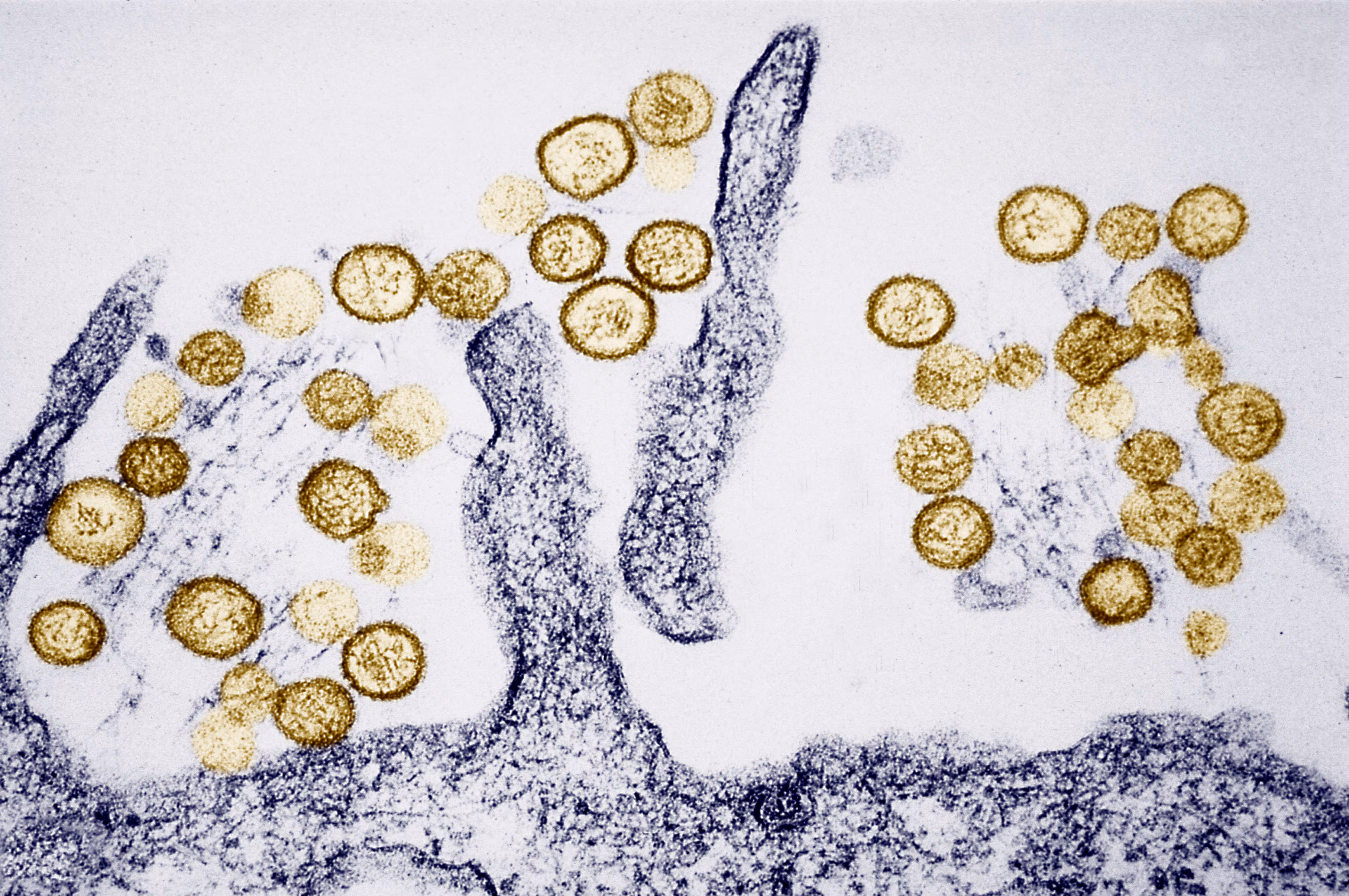 ¿Qué sabemos sobre el brote de hantavirus? Riesgos y certezas de una enfermedad mortal, pero muy poco contagiosa